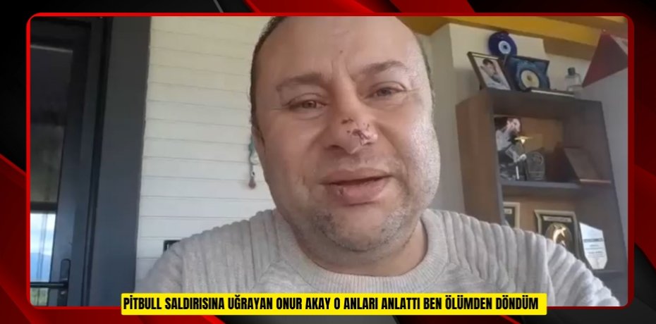 Pitbull saldırısına uğrayan Onur Akay o anları anlattı: "Ben ölümden döndüm"